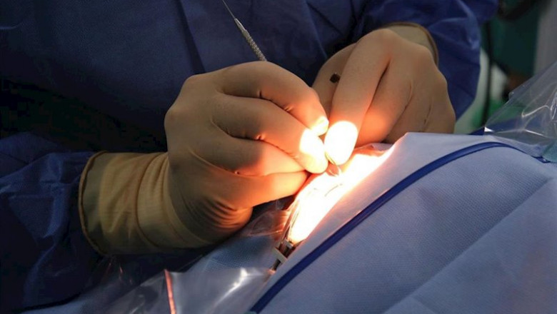 Cirugano, médico, medicina, quirófano, operar, operación, operando, cirugía | EUROPA PRESS - Archivo ep cirugano medico medicina quirofano operar operacion operando cirugia