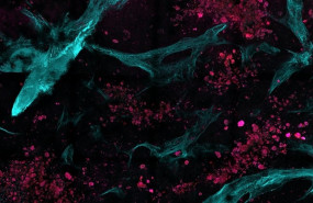 ep os investigadores combinaronmicroscopia multiphotonalgoritmos automatizadosimagenanalisis estadisticodistinguirtejido sanoenfermo