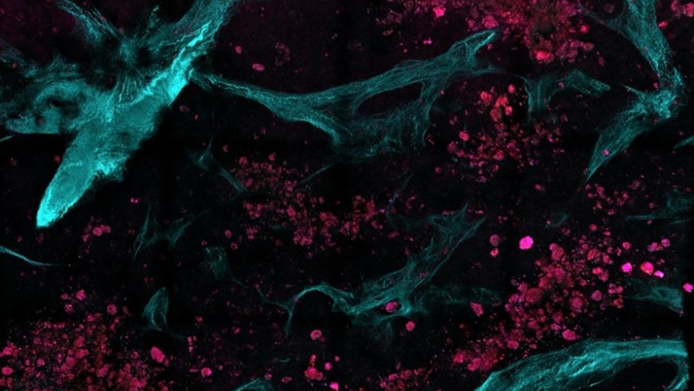 Os investigadores combinaron la microscopía multiphoton con algoritmos automatizados de imagen y análisis estadístico para distinguir entre tejido sano y enfermo. | POULI, SCHNELLDORFER E GEORGAKOUDI - Archivo ep os investigadores combinaronmicroscopia multiphotonalgoritmos automatizadosimagenanalisis estadisticodistinguirtejido sanoenfermo